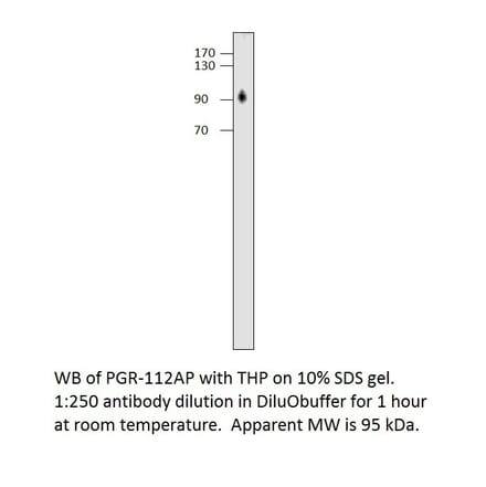 Anti-Progesterone Receptor Antibody from FabGennix (PGR-112AP) - Antibodies.com