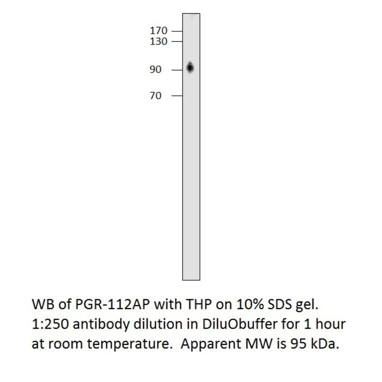 Anti-Progesterone Receptor Antibody from FabGennix (PGR-112AP) - Antibodies.com