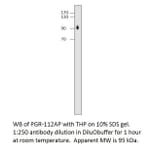 Anti-Progesterone Receptor Antibody from FabGennix (PGR-112AP) - Antibodies.com