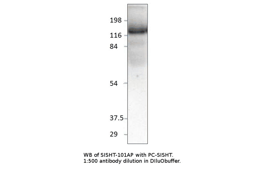 Anti-Slingshot homolog 1 Antibody from FabGennix (SISHT-101AP) - Antibodies.com
