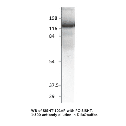 Anti-Slingshot homolog 1 Antibody from FabGennix (SISHT-101AP) - Antibodies.com