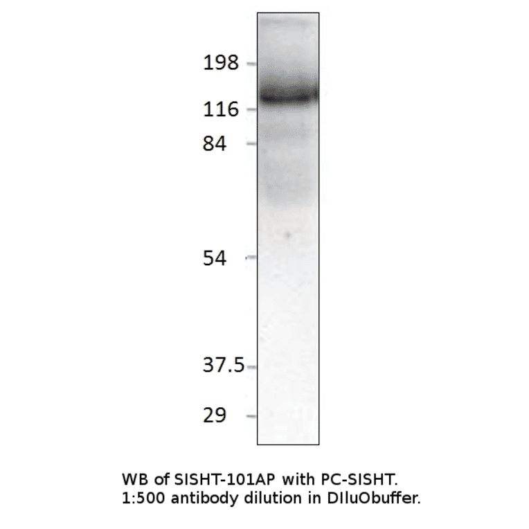 Anti-Slingshot homolog 1 Antibody from FabGennix (SISHT-101AP) - Antibodies.com