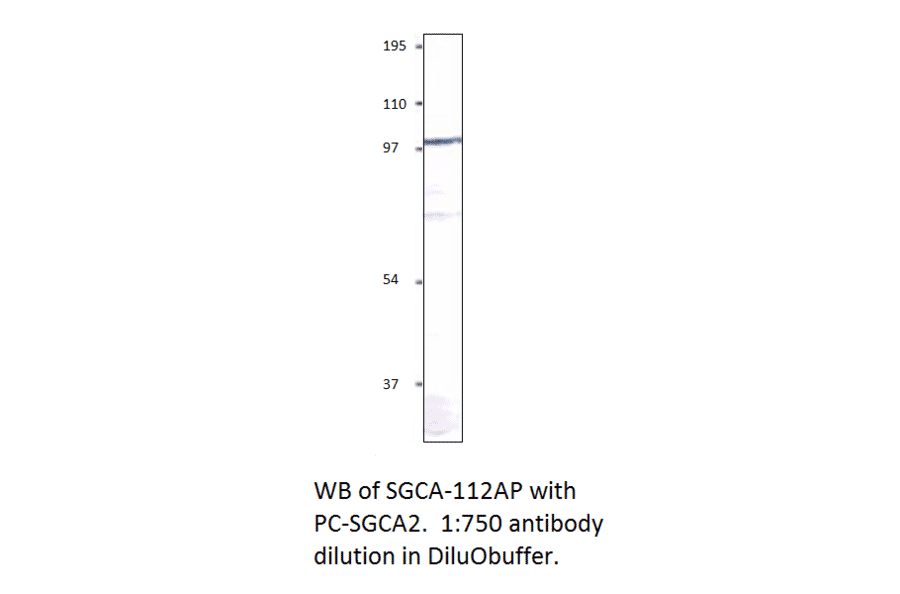 Anti-Soluble Guanylyl Cyclase alpha 2 Antibody from FabGennix (SGCA-112AP) - Antibodies.com