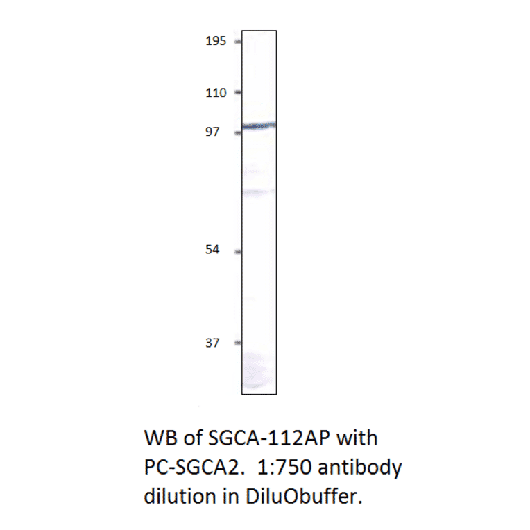 Anti-Soluble Guanylyl Cyclase alpha 2 Antibody from FabGennix (SGCA-112AP) - Antibodies.com