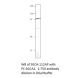 Anti-Soluble Guanylyl Cyclase alpha 2 Antibody from FabGennix (SGCA-112AP) - Antibodies.com