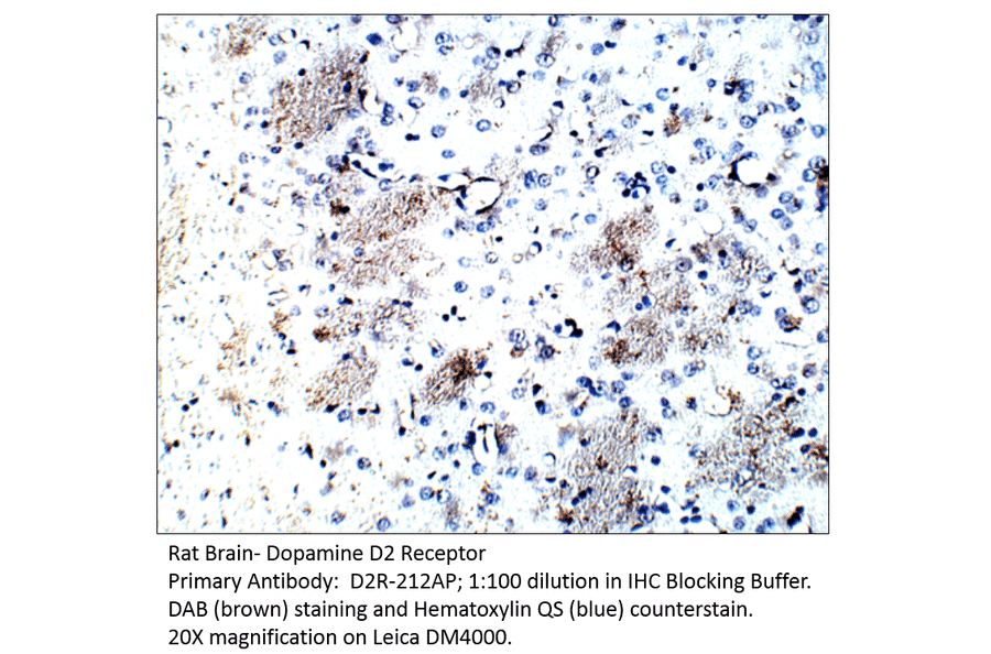Anti-Dopamine D2 Receptor Antibody from FabGennix (D2R-212AP) - Antibodies.com
