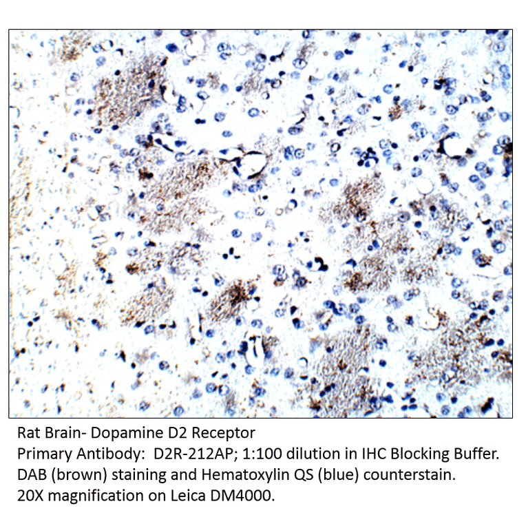 Anti-Dopamine D2 Receptor Antibody from FabGennix (D2R-212AP) - Antibodies.com