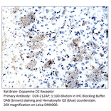 Anti-Dopamine D2 Receptor Antibody from FabGennix (D2R-212AP) - Antibodies.com