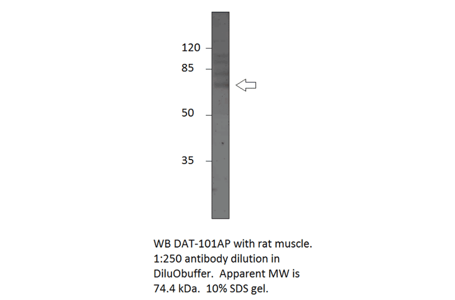 Anti-Dopamine Transporter Antibody from FabGennix (DAT-101AP) - Antibodies.com