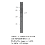 Anti-Dopamine Transporter Antibody from FabGennix (DAT-101AP) - Antibodies.com