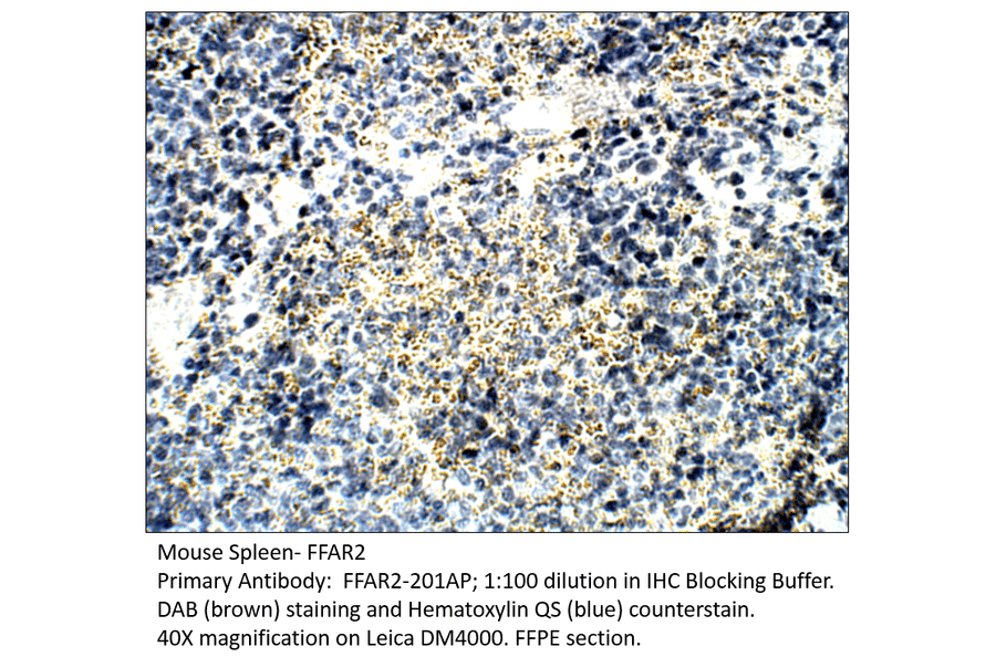 Anti-GPCR GPR43 / FFAR2 Antibody from FabGennix (FFAR2-201AP) - Antibodies.com