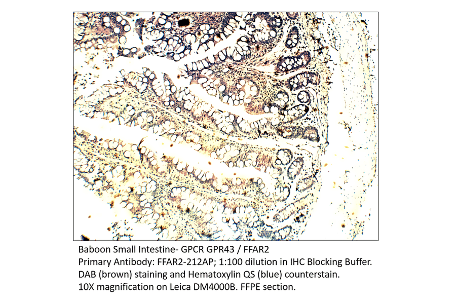 Anti-GPCR GPR43 / FFAR2 Antibody from FabGennix (FFAR2-212AP) - Antibodies.com