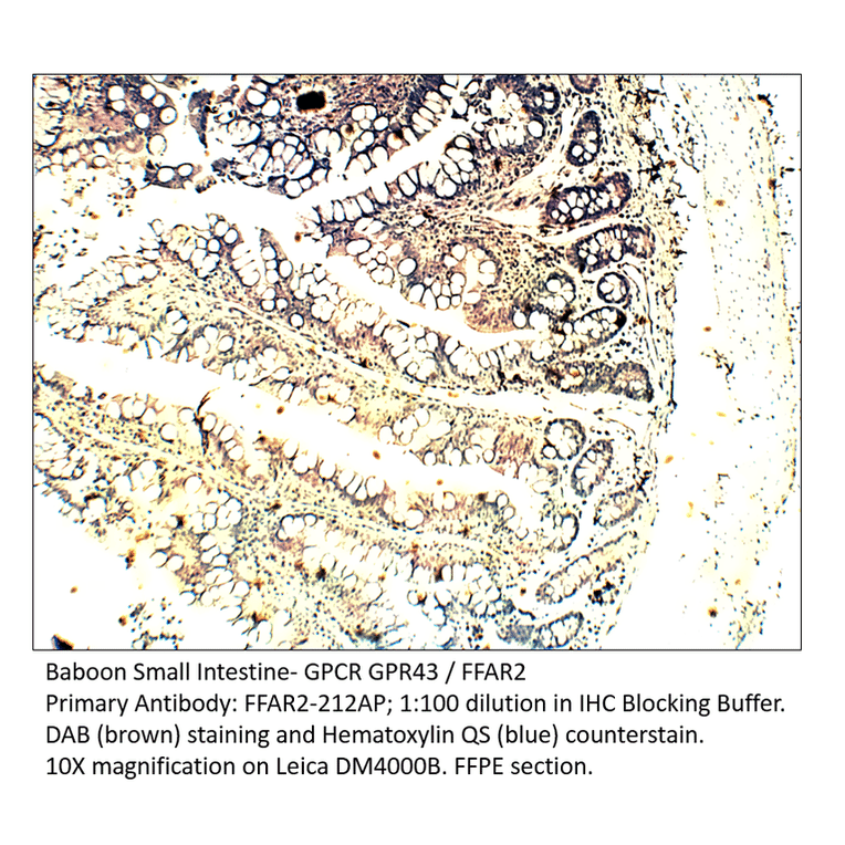 Anti-GPCR GPR43 / FFAR2 Antibody from FabGennix (FFAR2-212AP) - Antibodies.com