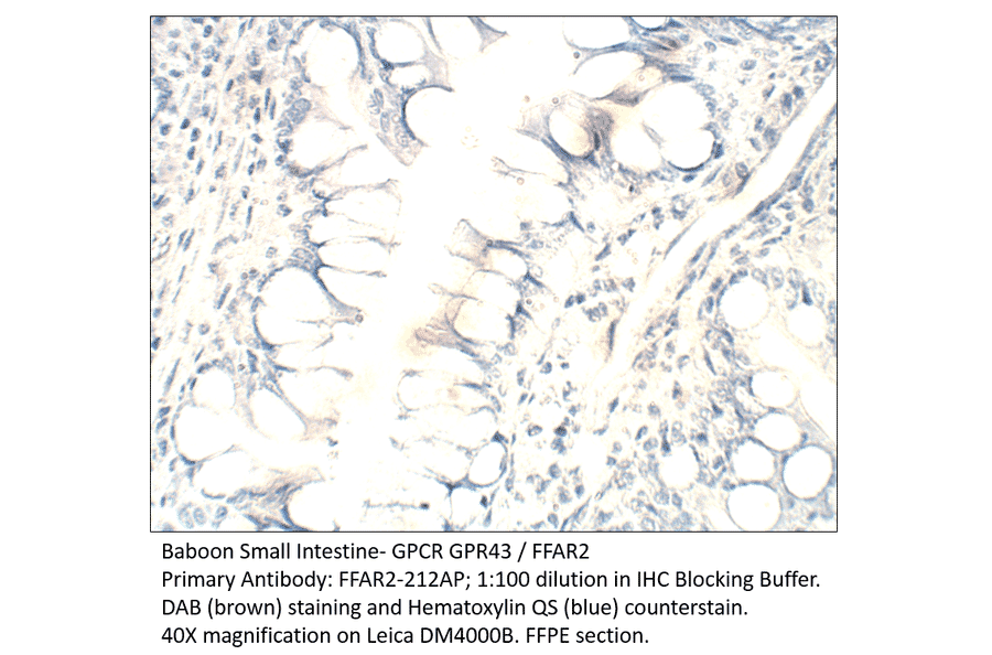 Anti-GPCR GPR43 / FFAR2 Antibody from FabGennix (FFAR2-212AP) - Antibodies.com