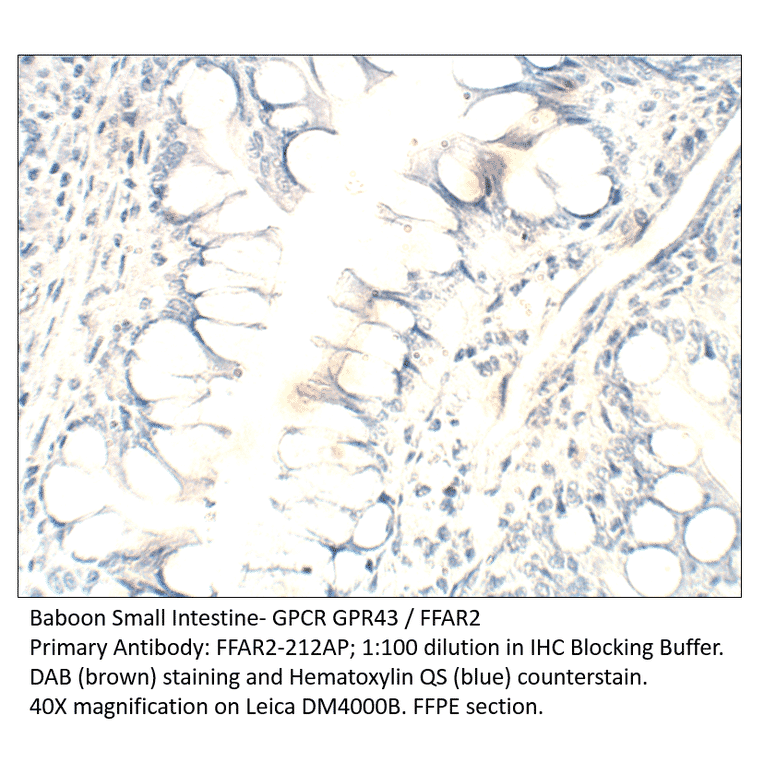 Anti-GPCR GPR43 / FFAR2 Antibody from FabGennix (FFAR2-212AP) - Antibodies.com
