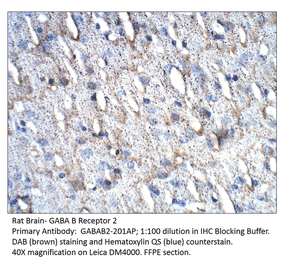 Anti-GABA B Receptor 2 Antibody from FabGennix (GABAB2-201AP) - Antibodies.com