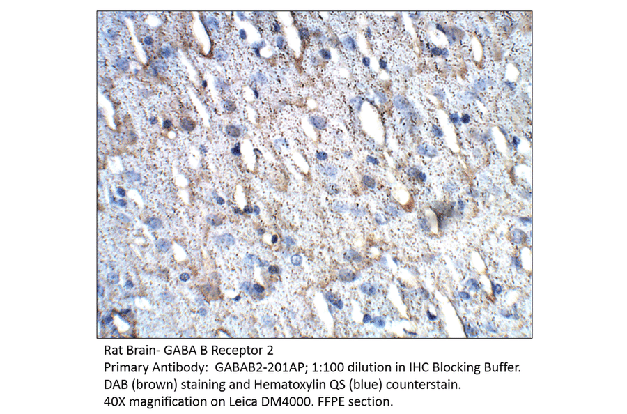 Anti-GABA B Receptor 2 Antibody from FabGennix (GABAB2-201AP) - Antibodies.com