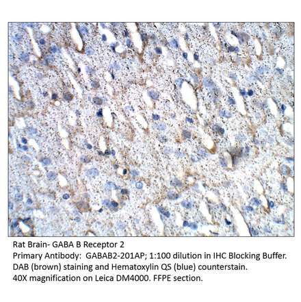 Anti-GABA B Receptor 2 Antibody from FabGennix (GABAB2-201AP) - Antibodies.com