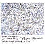 Anti-GABA B Receptor 2 Antibody from FabGennix (GABAB2-201AP) - Antibodies.com