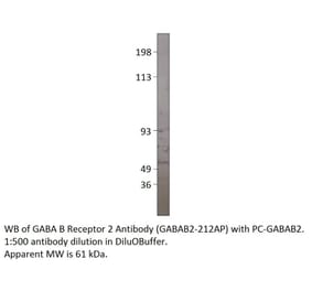 Anti-GABA B Receptor 2 Antibody from FabGennix (GABAB2-212AP) - Antibodies.com