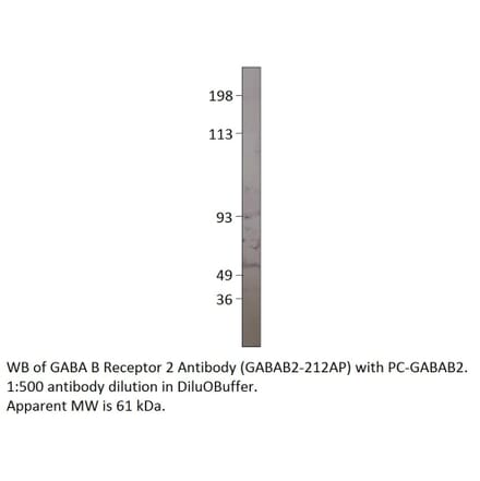 Anti-GABA B Receptor 2 Antibody from FabGennix (GABAB2-212AP) - Antibodies.com