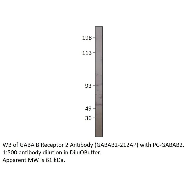 Anti-GABA B Receptor 2 Antibody from FabGennix (GABAB2-212AP) - Antibodies.com