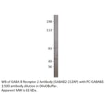Anti-GABA B Receptor 2 Antibody from FabGennix (GABAB2-212AP) - Antibodies.com