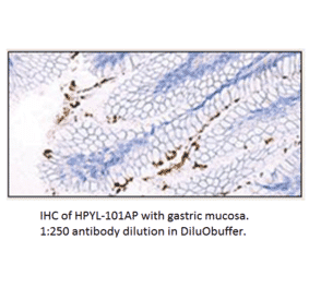 Anti-Helicobacter pylori Antibody from FabGennix (HPYL-101AP) - Antibodies.com