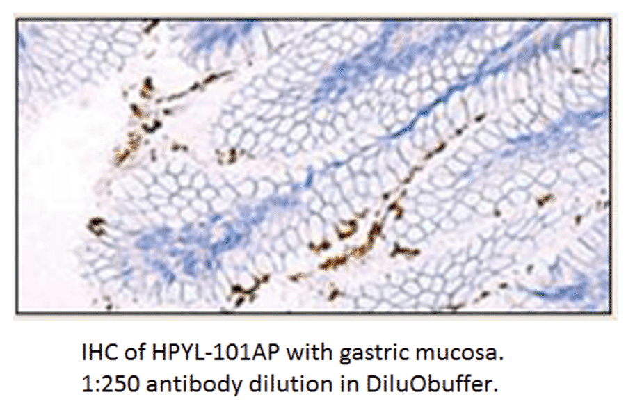 Anti-Helicobacter pylori Antibody from FabGennix (HPYL-101AP) - Antibodies.com