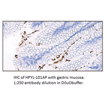 Anti-Helicobacter pylori Antibody from FabGennix (HPYL-101AP) - Antibodies.com