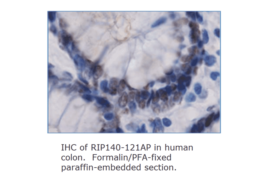 Anti-RIP140 Antibody ChIP grade from FabGennix (RIP140-121AP) - Antibodies.com