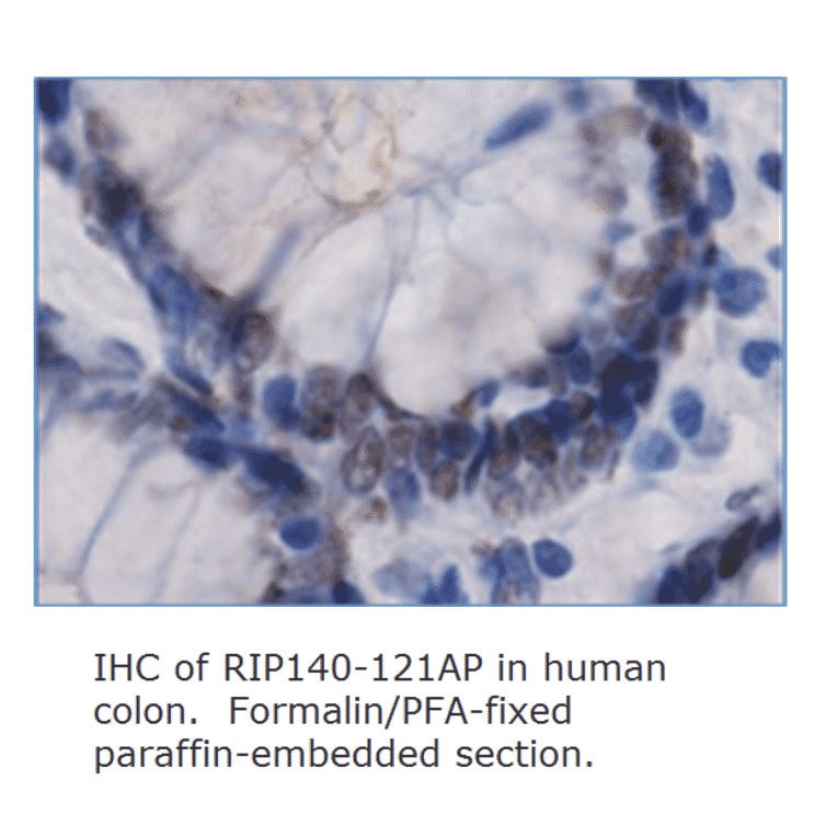 Anti-RIP140 Antibody ChIP grade from FabGennix (RIP140-121AP) - Antibodies.com