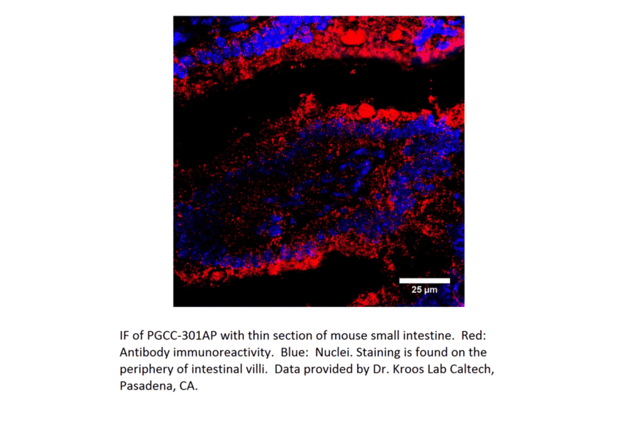 Anti-Particulate Guanylate Cyclase C Antibody from FabGennix (PGCC-301AP) - Antibodies.com