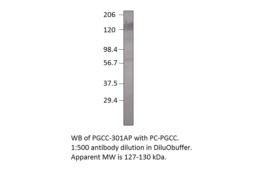 Anti-Particulate Guanylate Cyclase C Antibody from FabGennix (PGCC-301AP) - Antibodies.com