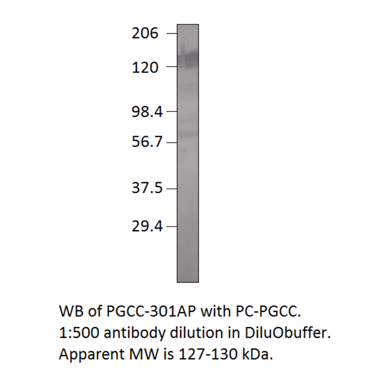 Anti-Particulate Guanylate Cyclase C Antibody from FabGennix (PGCC-301AP) - Antibodies.com