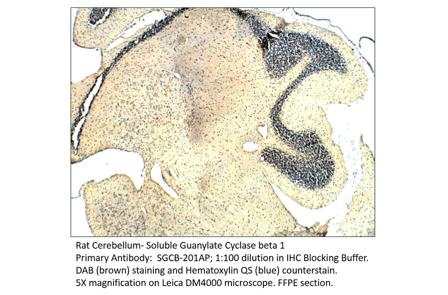 Anti-Soluble Guanylyl Cyclase beta 1 Antibody from FabGennix (SGCB-201AP) - Antibodies.com