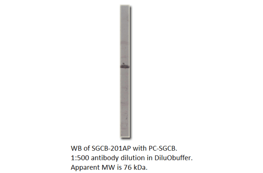 Anti-Soluble Guanylyl Cyclase beta 1 Antibody from FabGennix (SGCB-201AP) - Antibodies.com