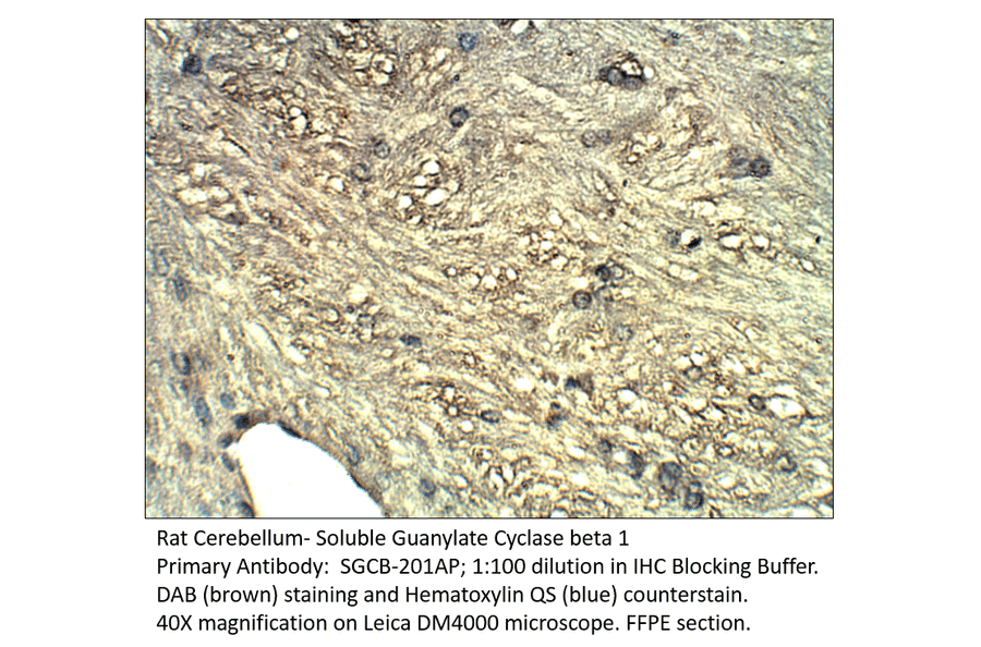 Anti-Soluble Guanylyl Cyclase beta 1 Antibody from FabGennix (SGCB-201AP) - Antibodies.com
