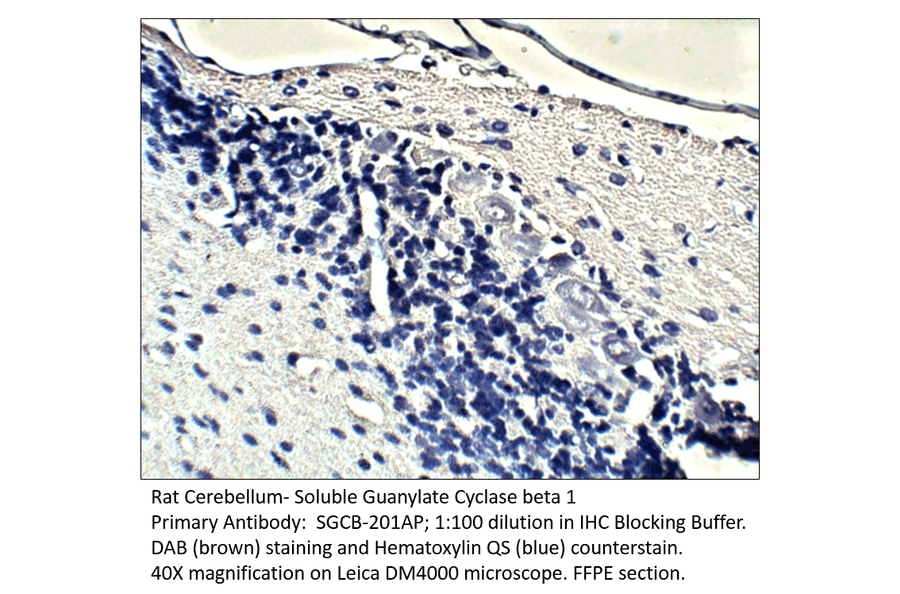 Anti-Soluble Guanylyl Cyclase beta 1 Antibody from FabGennix (SGCB-201AP) - Antibodies.com