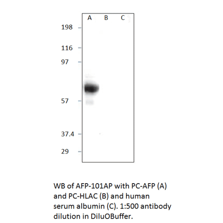 Anti-Alpha 1 Fetoprotein Antibody from FabGennix (AFP-101AP) - Antibodies.com