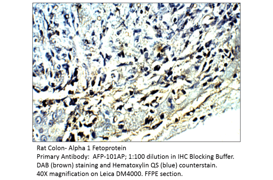 Anti-Alpha 1 Fetoprotein Antibody from FabGennix (AFP-101AP) - Antibodies.com