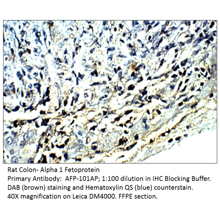 Anti-Alpha 1 Fetoprotein Antibody from FabGennix (AFP-101AP) - Antibodies.com