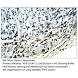 Anti-Alpha 1 Fetoprotein Antibody from FabGennix (AFP-101AP) - Antibodies.com