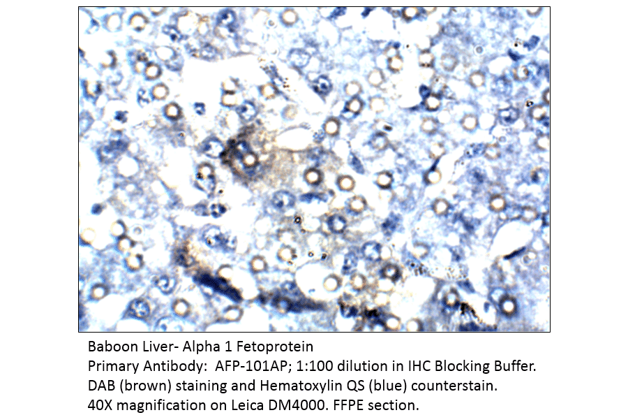Anti-Alpha 1 Fetoprotein Antibody from FabGennix (AFP-101AP) - Antibodies.com