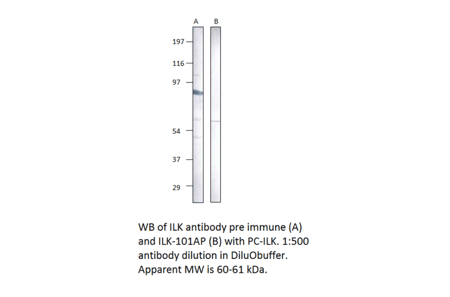 Anti-Integrin linked ILK Antibody from FabGennix (ILK-101AP) - Antibodies.com