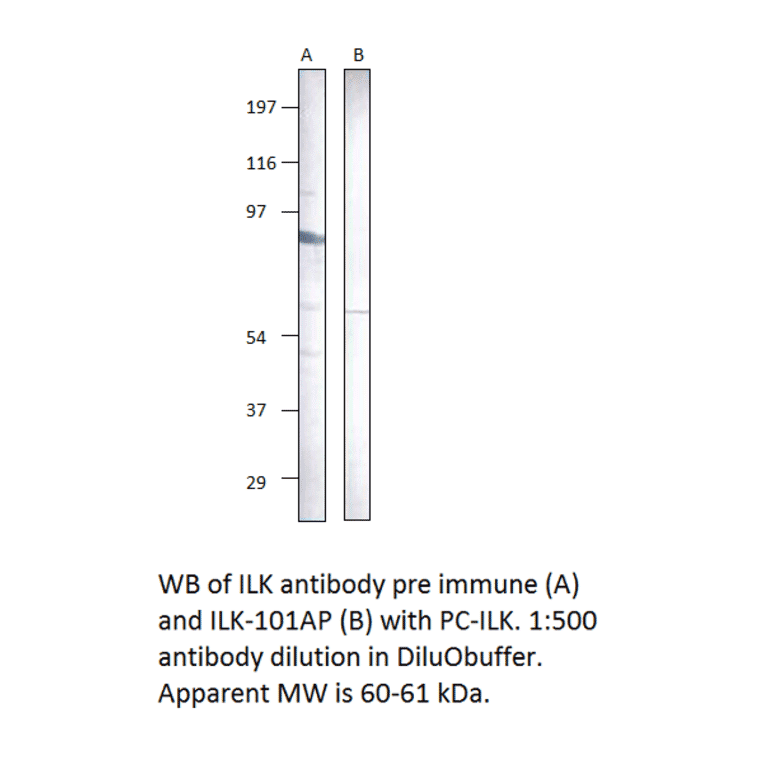 Anti-Integrin linked ILK Antibody from FabGennix (ILK-101AP) - Antibodies.com