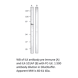 Anti-Integrin linked ILK Antibody from FabGennix (ILK-101AP) - Antibodies.com