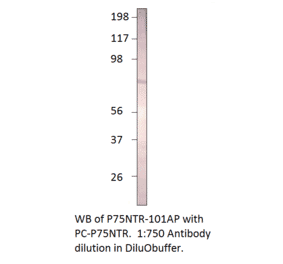 Anti-p75 NGF Receptor Antibody from FabGennix (P75NTR-101AP) - Antibodies.com