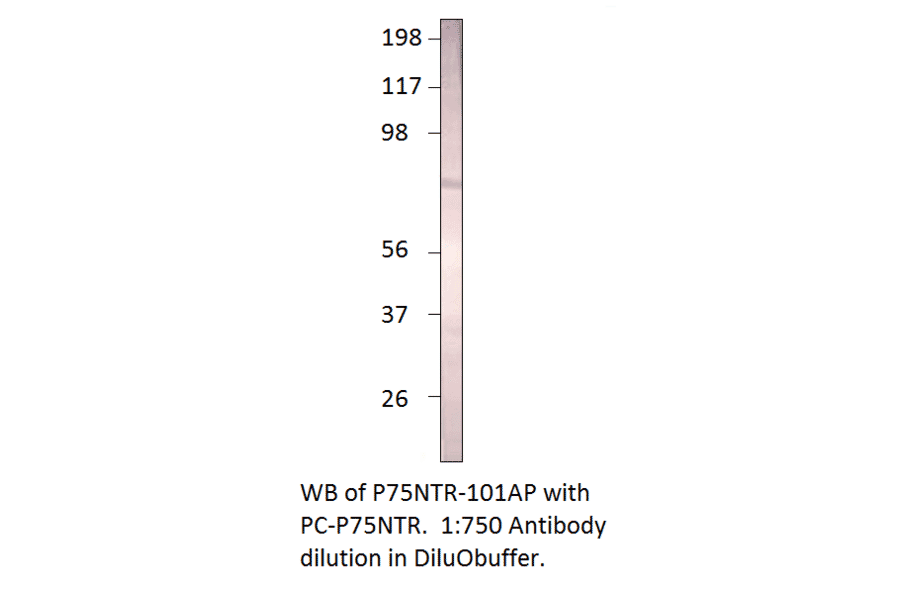 Anti-p75 NGF Receptor Antibody from FabGennix (P75NTR-101AP) - Antibodies.com
