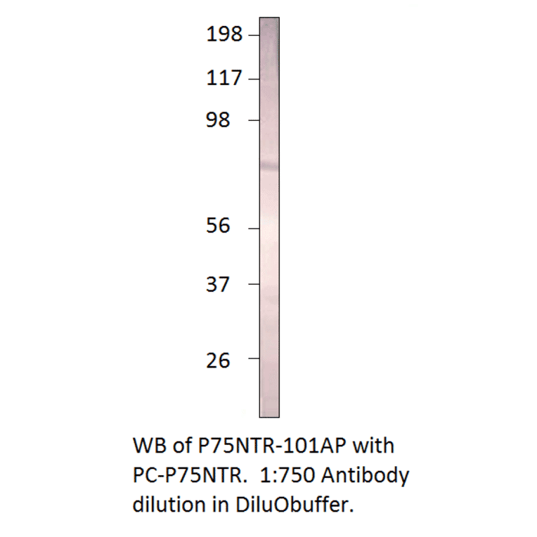 Anti-p75 NGF Receptor Antibody from FabGennix (P75NTR-101AP) - Antibodies.com